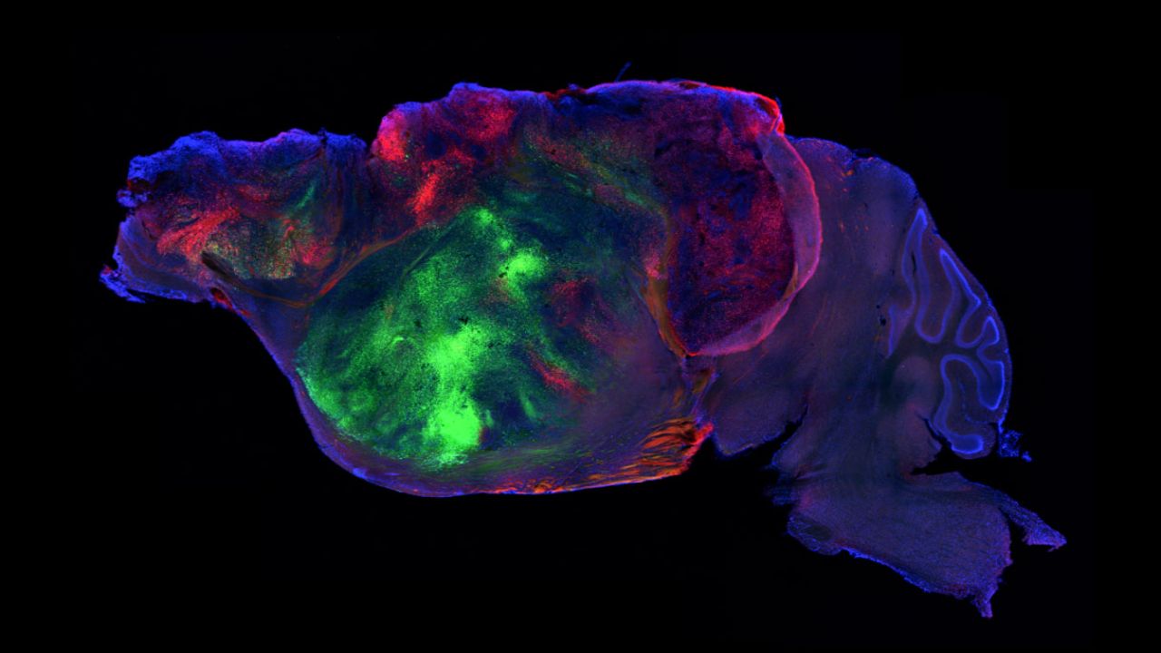 Rare Human Neurons Never Grown in a Dish Appeared Inside Mouse Brains in a Stanford Experiment