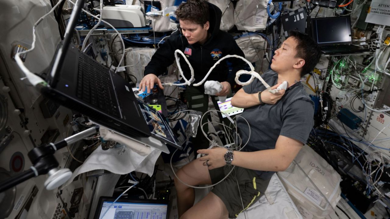 NASA Seeks Outside Research to Prevent and Treat Blood Clots in Space as Station Scans Point to Stalled Neck Vein Flow