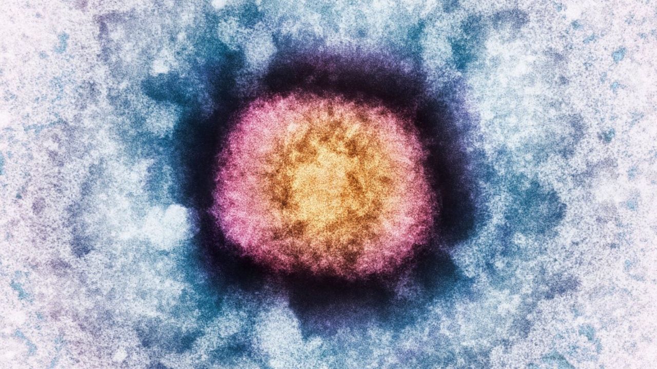 Human DNA Turned Up Inside a Poxvirus, Exposing the First Known Gene That Both Works and Still Jumps