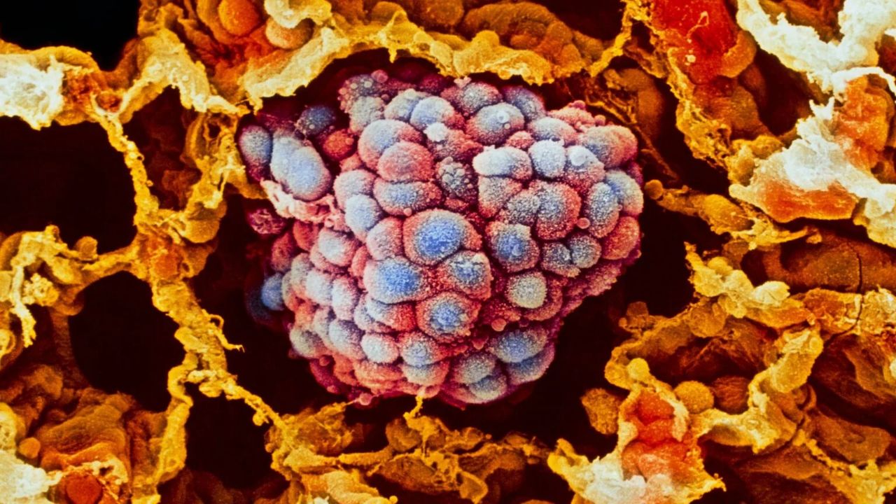 A Common Deworming Drug Slowed Drug-Resistant Lung Tumors in Mice When Paired with a Targeted Cancer Drug