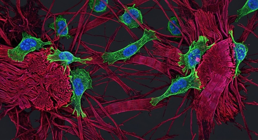 Immune Cells Can Sense Tissue Stiffness, and Stiffer Surroundings Push Them to Stand Guard, McGill Study Finds