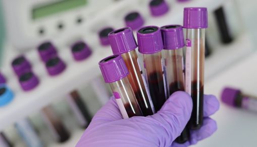 People with Blood Type A More Prone to COVID-19, Study Says