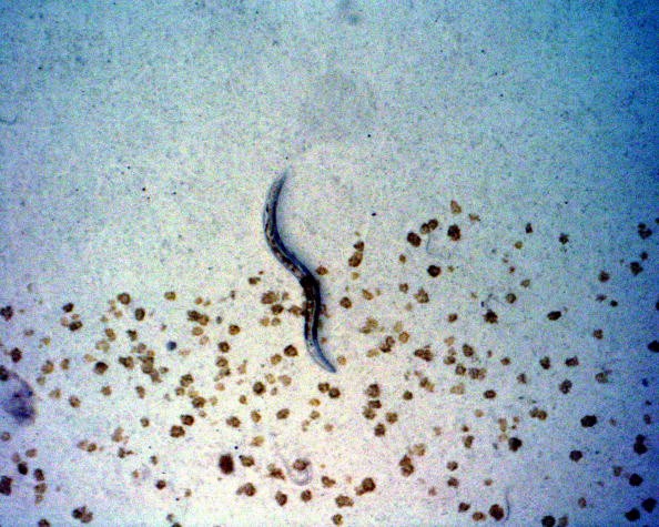 Worm