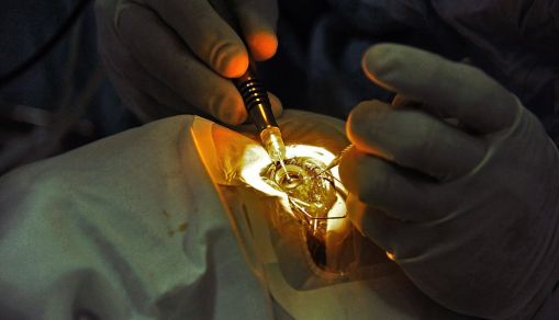 SOMALIA-PAKISTAN-HEALTH