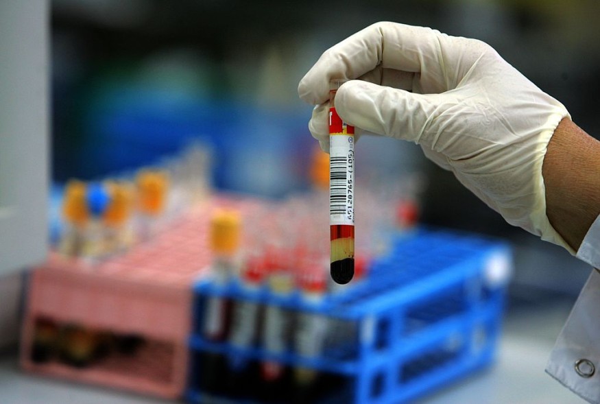 Israeli Laboratory Leads Western World In Blood Testing