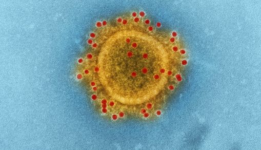 Nipah Virus Outbreak